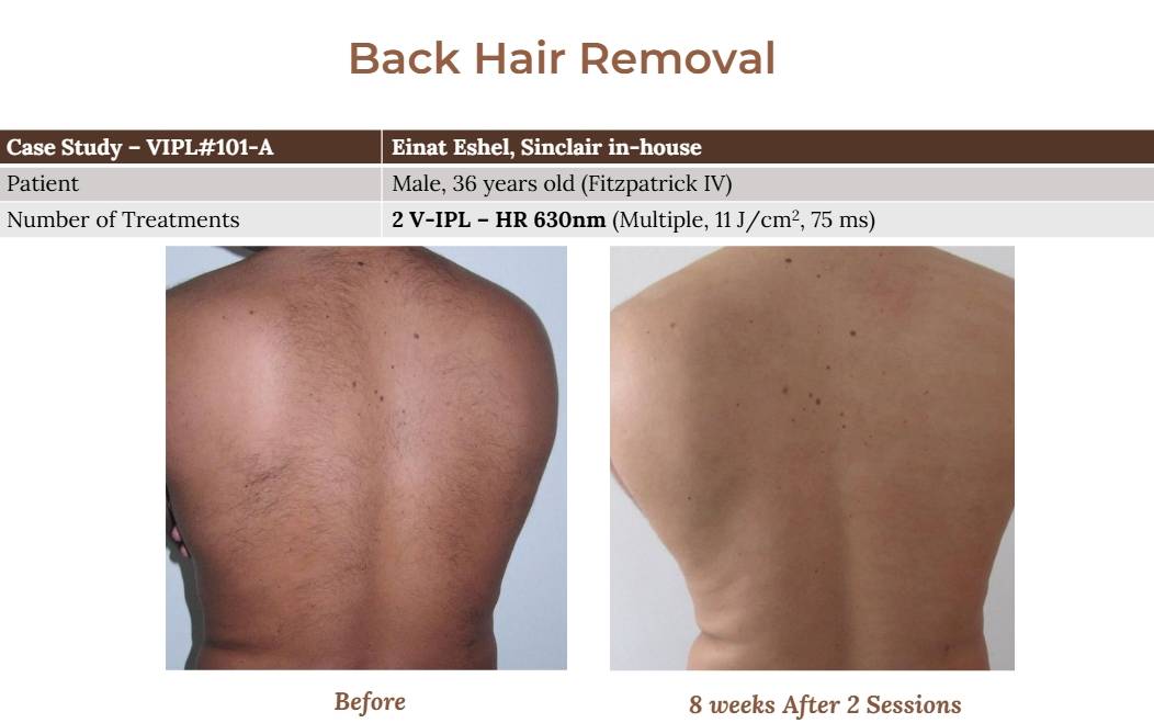 V-IPL case studies