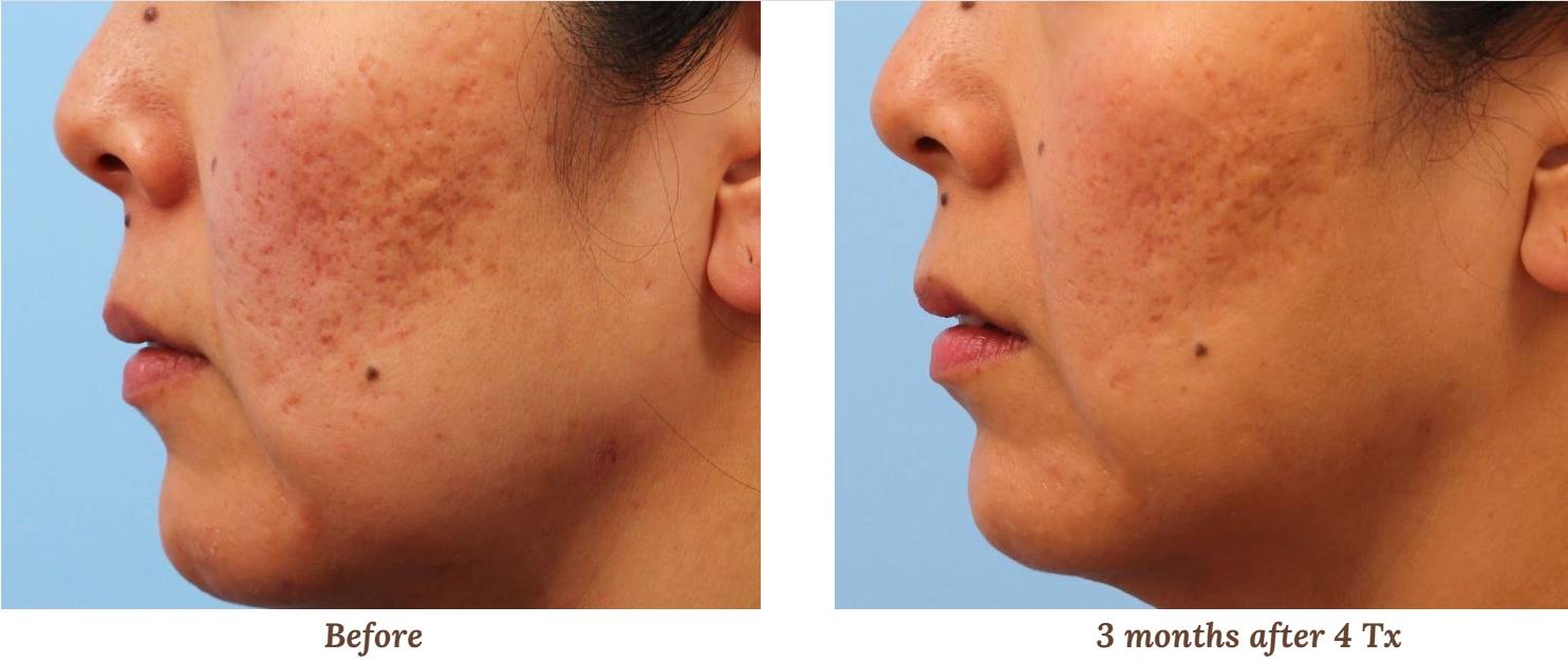 V-FR case studies