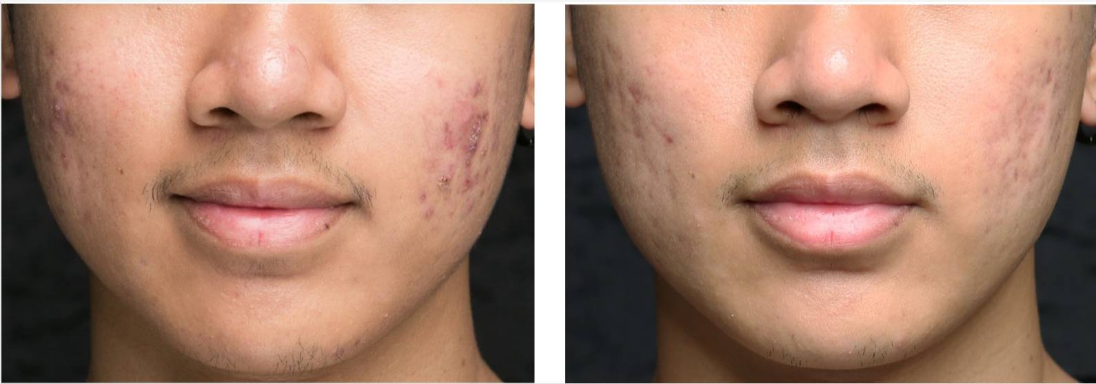 V-FR case studies