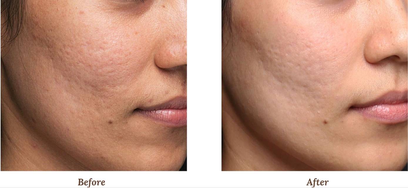 V-FR case studies