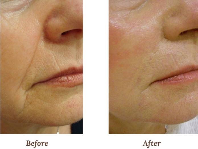 V-FR case studies