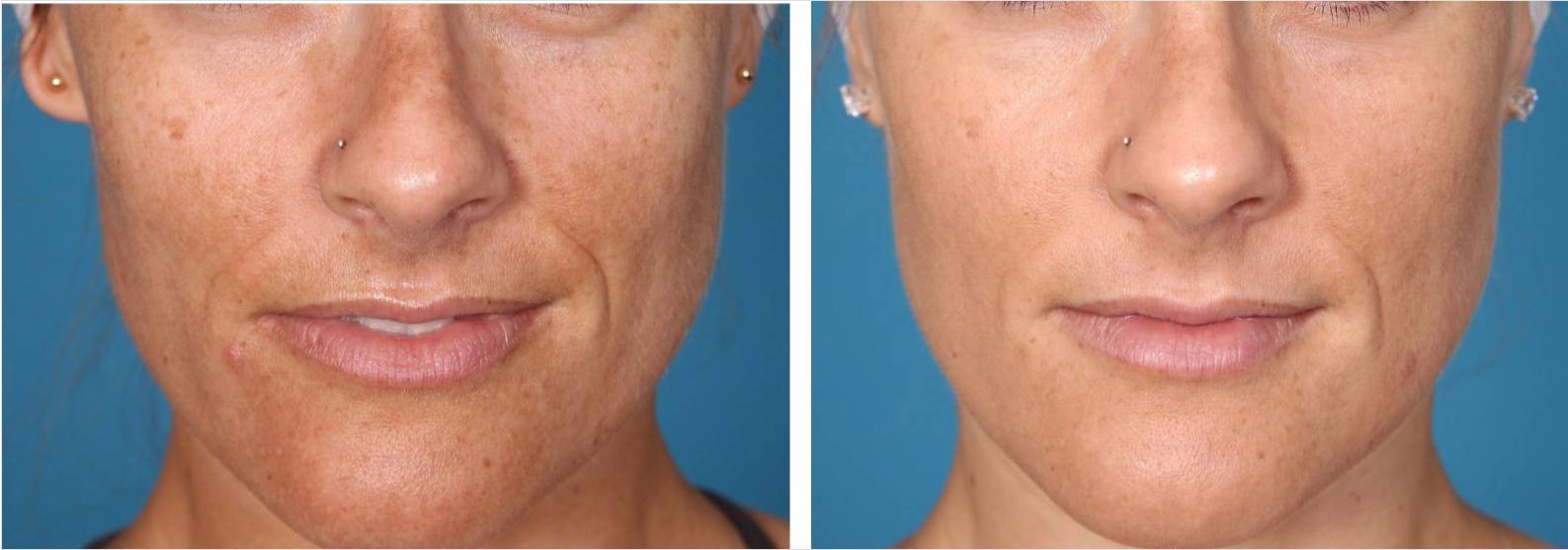 V-FR case studies